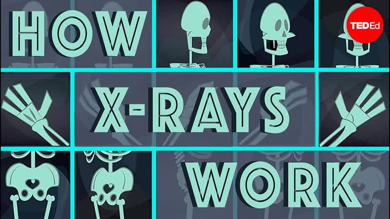 How X rays see through your skin Ge