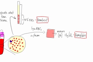 Anemia:  Basic lab tests - hematocrit, hemoglobin, reticulocyte, MCV, morphology