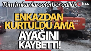 Enkaz Altında Kalan Vatandaş Ayağı Ampüte Edilerek Kurtarıldı