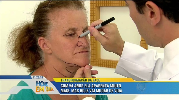 Transformação da face: Maria de Lourdes recupera a