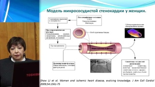 Микрососудистая стенокардия, д. м. н. Г. Н. Соболева