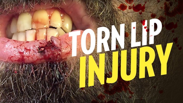 Quick torn lip injury SFX makeup