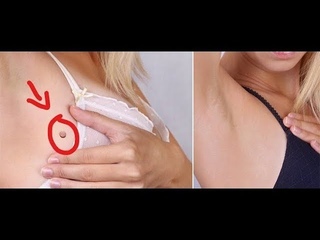 ► ELIMINA tus VERRUGAS en MENOS de 1 DÍA ◄ Elimina verrugas naturalmente || HaunterMake