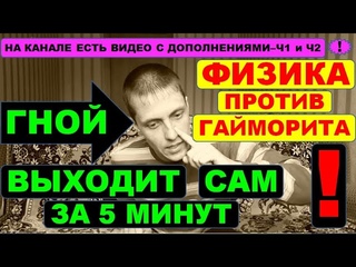 ГАЙМОРИТ, СИНУСИТ. ГНОЙ вылетит сам⚠️силами ФИЗИКИ ☝️ Мгновенное лечение МЕТОДОМ САМОПРОДУВКИ✔