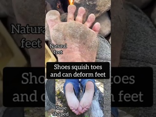 Why you should walk barefoot ep 34 | natural feet #shorts