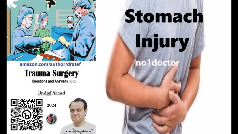 Stomach Injury A Comprehensive Guide for Medical Professionals, stomachinjury, medicine,