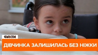 😳 6-річна дівчинка залишилась без ніжки після ракетного обстрілу у Затоці
