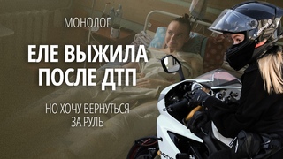 «Мечтаю о протезе и мотоцикле». #Монолог о жизни после ампутации ноги