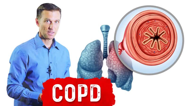 Chronic Obstructive Pulmonary Disease (