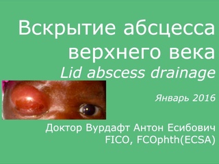 Вскрытие абсцесса века (Lid abscess incision and drainage)