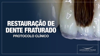 Restauração de Dente Fraturado. Protocolo Clínico