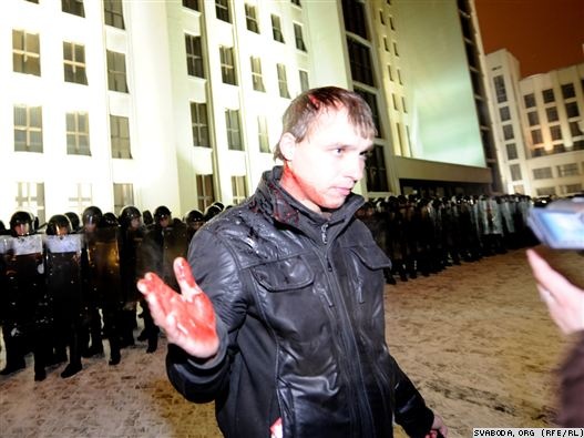 №75, Васіль Герасімчык, 38 лет, Озеры №75, Васіль Герасімчык, 38 лет, Озеры