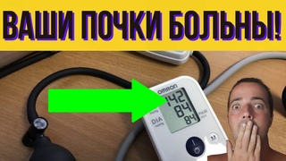 ВЫ ЭТОГО НЕ ЗНАЛИ! СКРЫТЫЕ СИМПТОМЫ БОЛЬНЫХ ПОЧЕК!