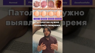 Кривой череп исправим